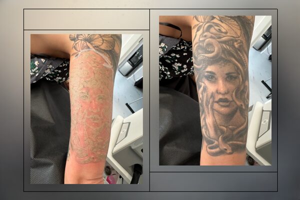 Na zdjęciu porównanie tatuaży