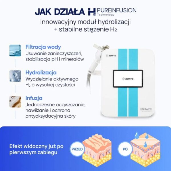 Zemits Eau Sante NG z technologią H₂ PureInfuseOn to innowacyjna hydradermabrazja z infuzją wodoru. Oczyszcza, nawilża i regeneruje skórę, zapewniając efekt świeżości i blasku – idealne rozwiązanie na zimowy sezon w salonie.