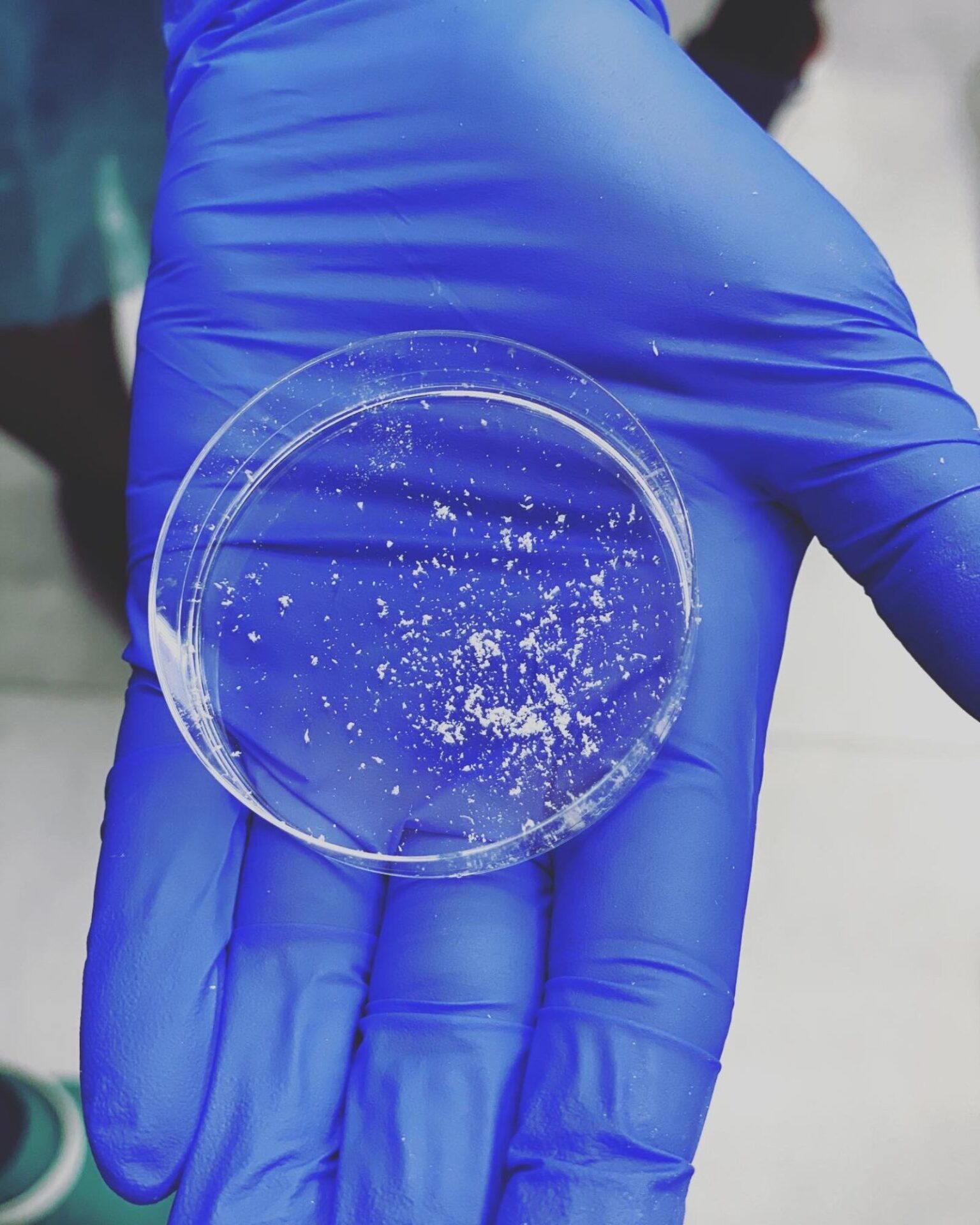 zeskrobiny do badania mykologicznego