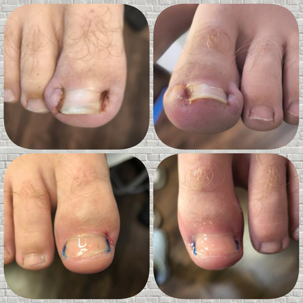 Zdjęcie palców w klinice Agnieszka Szewczyk