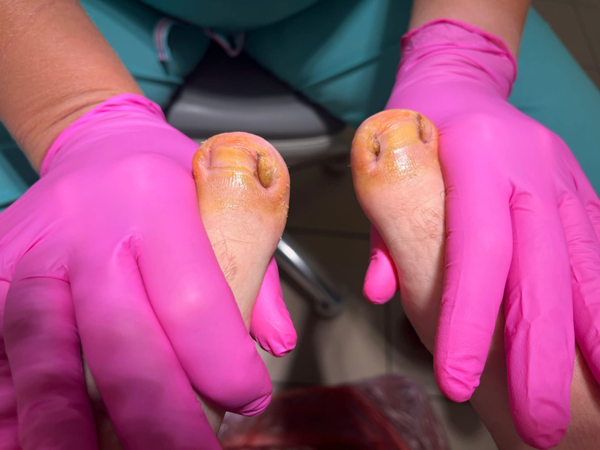 Zdjęcie palców w klinice Agnieszka Szewczyk