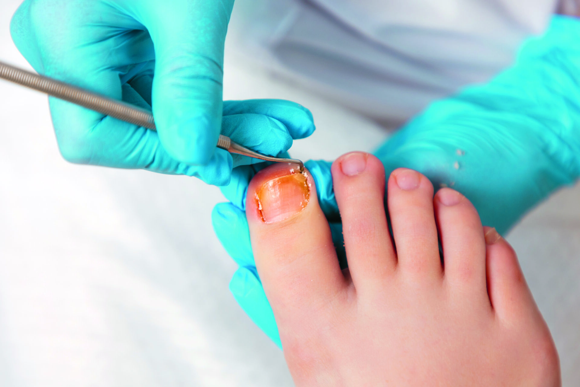 Kosmetyczka wykonuje pedicure na stopach klientki, oczyszczając paznokcie za pomocą dwustronnej kirety. Zbliżenie, widok z góry. Koncepcja profesjonalnej pielęgnacji paznokci i pedicure w salonie kosmetycznym.