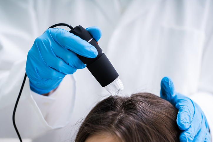 Zbliżenie na dermatologa korzystającego z trichoskopu w ramach leczenia wypadania włosów w swojej klinice