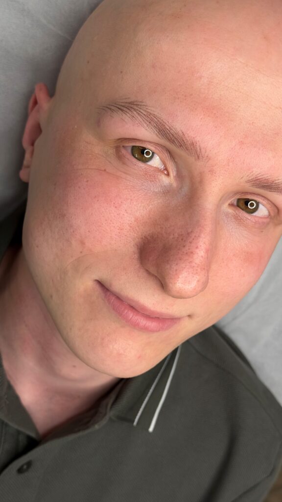 Pigmentacja brwi u mężczyzny z alopecją
